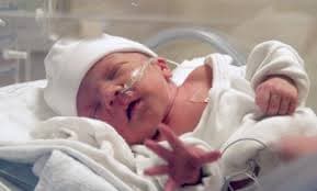 نوزاد زود متولد شده (نوزاد نارس - پره ترم )