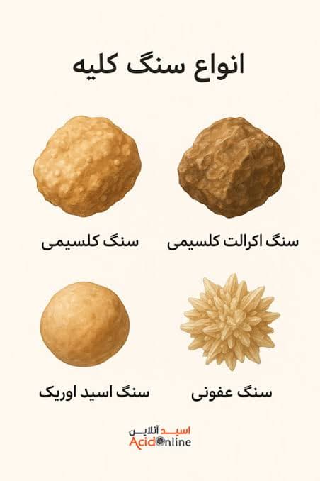 سنگ های ادراری ( جزوه آموزشی )
